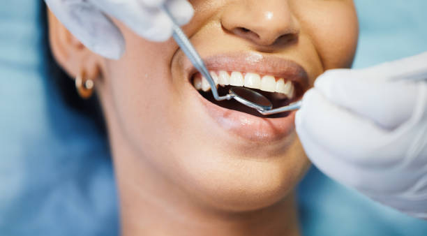 Best Emergency Tooth Extraction in Enon, OH